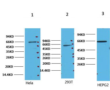 NF Kappa B p65 Monoclonal Antibody(14H2)