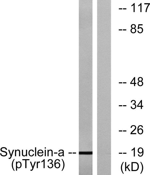 Synuclein-alpha(Phospho Tyr136) Polyclonal Antibody